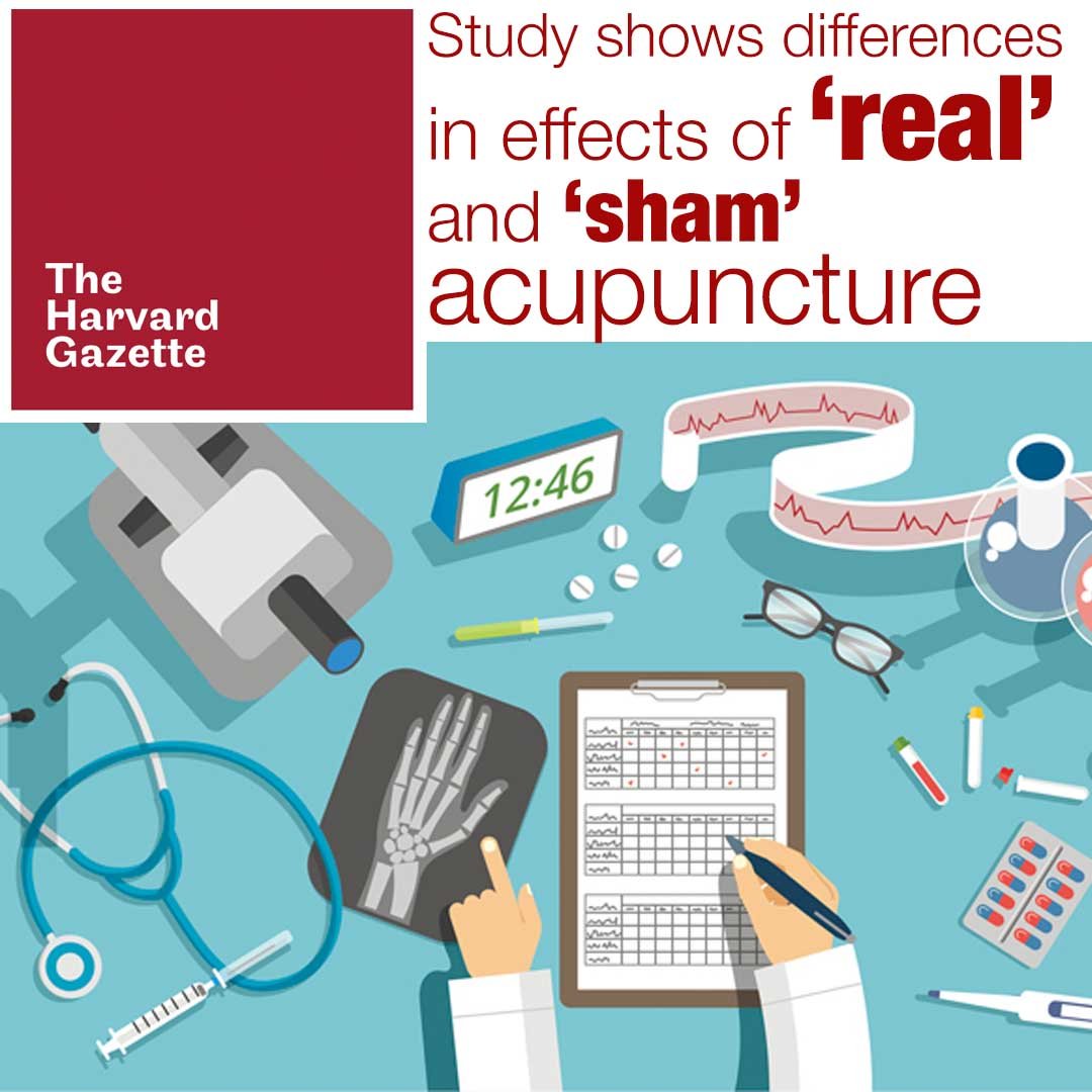 ‘sham’ vs real acupuncture DM Acupuncture